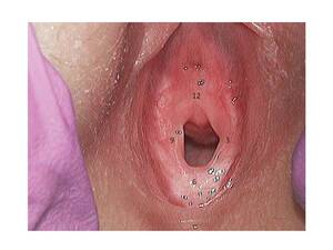 anal abused girl - Sexual Abuse and Assault - Cancer Therapy Advisor