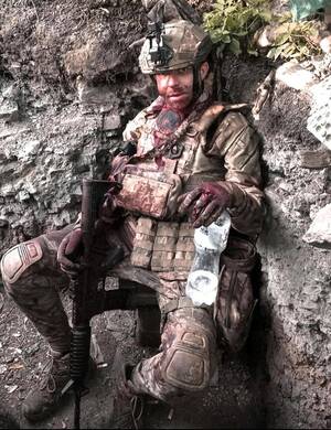 Military Porn - Wounded Ukrainian soldier after a fight [1024x1280] : r/MilitaryPorn