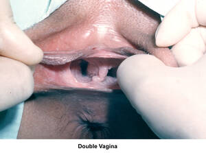 double vagina - double vagina | MOTHERLESS.COM â„¢