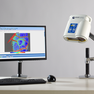 chen guan xi - Laser Speckle Contrast Imager - moorFLPI-2 - Moor Instruments