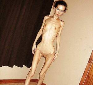 anorexic brunette - Extrem skinny and anorexic girls | MOTHERLESS.COM â„¢