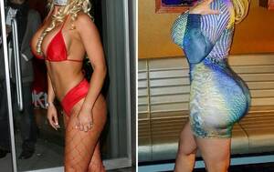 Fake Butt Implants Porn - Before-and-After Pics of Celebrities With Rumored Butt Implants | Life &  Style