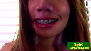 ladyboy braces facial - thai ladyboy with braces strokes and poses whats her name? - XVIDEOS.COM
