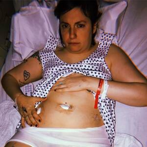 Lena Dunham Naked Porn - Lena Dunham Undergoes Surgery to Remove Ovary