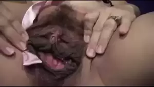 Huge Pussy Lip Removal - Free Pussy Lips Porn Videos | xHamster
