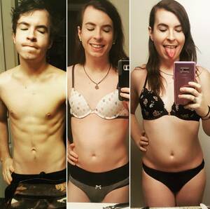 before and after nude transexual - Mtf before after - 77 photo