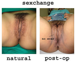 Male Sex Change Porn - Sex Change After Photos Xxx Porn Library | My XXX Hot Girl