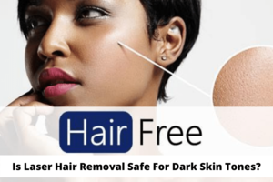 Megan Fox Gangbang Porn - Is Laser Hair Removal Safe For Dark Skin Tones? 3D Lifestyle PK