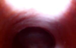 colon cam - Inflation free HD Porn Videos collection - Biguz.net