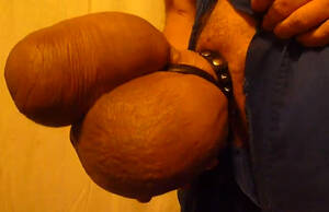 massive pumped cock and balls - Uncut cock and balls are swollen to huge size - penis pumping porn at  ThisVid tube