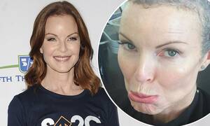 marcia cross anal sex - Marcia Cross vows to put an end to the stigma surrounding anal cancer |  Daily Mail Online