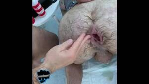 hairy ass fist - Fisting a big hairy ass in fistfest - ThisVid.com