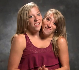 Conjoined Twins Sex Porn - Conjoined twins Abby and Brittany Hensel (see Comments for more info) :  r/BeAmazed