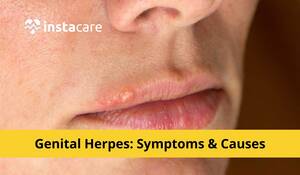 Herpes Porn Doctor - Genital Herpes Symptoms Causes And Treatment