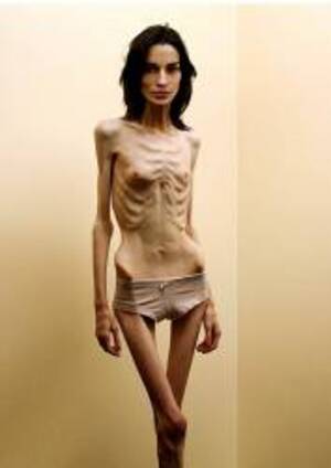 Anorexicporn Net - PICunt.com - ugly http://anorexicporn.net/back/anorexicnudes03.jpg