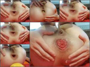 Kinky Ass Woman Porn - Anal Prolapse Video | Kinky Big Ass Girl Penetration Huge Plastic Ball  Fully In Anal Prolapse