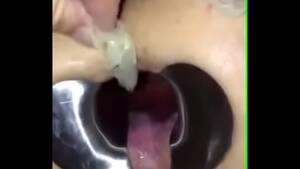 Condom Gag Porn - Older4you filling myself with used condoms from strangers - XVIDEOS.COM