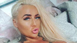 Botox Lips Porn - Porn Star Rushed To Hospital After Lip Filler Operation Goes Wrong -  LADbible