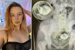 forced butt plug anal sex - Woman gets sex toy lodged up butt during steamy Facetime session