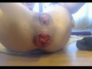 fisting gaping prolaps - Fisting Toying Gaping Prolapsed Asshole - Pornhub.com