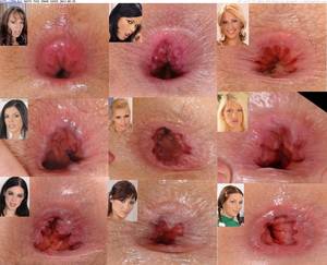 anal butthole - Gaping anal (asshole|butthole gape) of famous porn actresses (in Porn pics