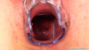 Deep In Vagina - Look At Her Deep Vagina - EPORNER