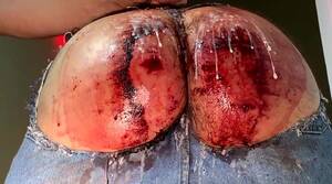 girls bottoms spanked bleeding - Bloody Spanking Porn | BDSM Fetish