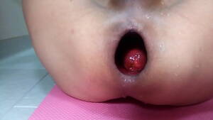 anus - Inside of the anus? - XVIDEOS.COM