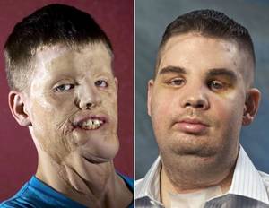 Disfigured Guy - 