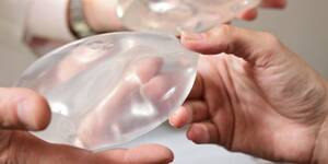 Forced Breast Implants Porn - Why thousands of women are having their breast implants removed | Fox News