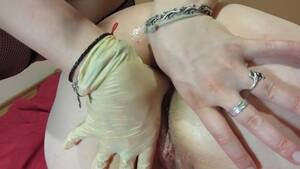 gloves anal plumper - Anal and Vaginal Fisting with Medical Gloves Mature BBW MILF Lesbians -  Lesbian Porn Videos