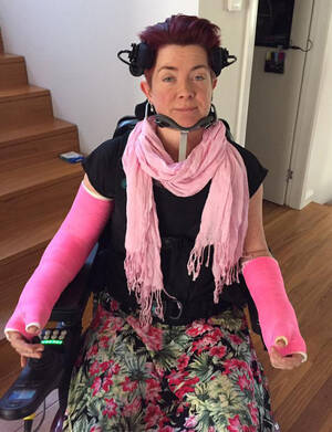 Braces Fetish Porn Tumblr - Minerva Brace Fetish - IgFAP