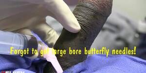 big fat cock priapism - Nurse Observes Priapism Procedure - Tnaflix.com