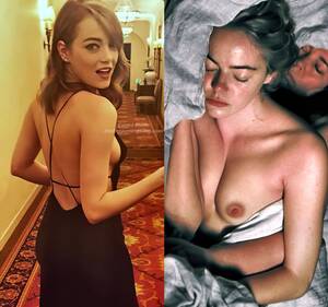Emma Stone Nude Naked Porn - Emma Stone Nude Photos & Videos 2023 | #TheFappening