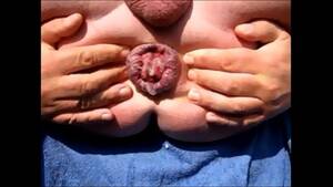 Disfigured Porn Asshole - extreme asshole - XVIDEOS.COM