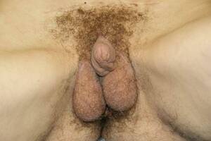 before and after nude transexual - Transsexual Surgery Before After - XXGASM