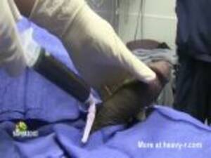 big fat cock priapism - Priapism Emergency