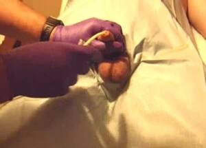 Catheter Insertion Porn - The catheter is inserted into the penis - ThisVid.com