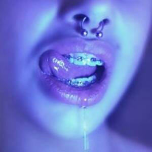 Braces Fetish Porn Tumblr - Brace Fetish Tumblr Porn