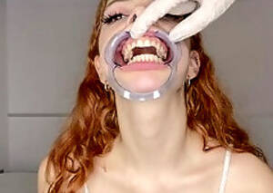 Mouth Dental - Dentist Porn