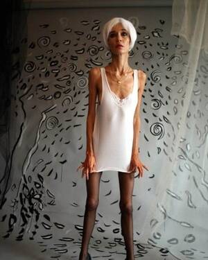 beautiful skinny nudist - beautiful super skinny girls posing nude Porn Pictures, XXX Photos, Sex  Images #2953385 - PICTOA