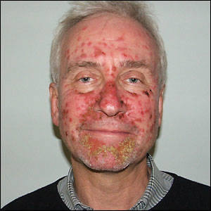 John Holmes - Ron Jeremy And John Holmes share a blonde John Homes Delivers John Holmes  and Candy Samples. John Holmes, died of AIDS March 13th, 1988 The gang  returned ...