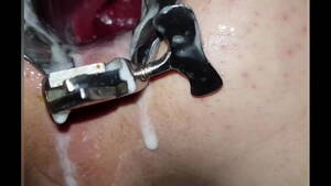 Male Speculum Porn - Anal speculum stretching - XVIDEOS.COM