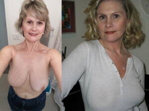 granny tits before after - Granny Tits Before After | Sex Pictures Pass