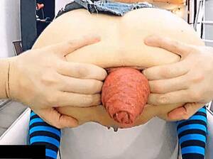 extreme ass destruction - Extreme Anal Prolapse of destroyed Ass of dirty bitch - ThisVid.com