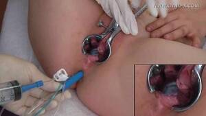 Gyno Enema Porn - Rozalia gyno enema and speculum - ThisVid.com