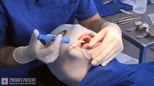 Dental Fetish Porn - Dental Exam Â« Hardcore Extreme â€“ BDSM & Fetish Porn