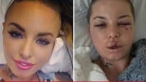 Christy Mack Before Porn - Porn Star Christy Mack -- Free Facial Reconstruction