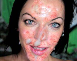 Acne Porn Chubby - Acne faced whore sofie loves sperm in ass and face | MOTHERLESS.COM â„¢