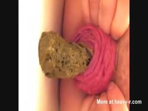 Disfigured Porn Asshole - Woman Deformed Asshole Ugly Anus Videos - Free Porn Videos